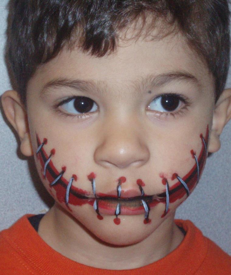 gacon-cicatrice-bouche-fil