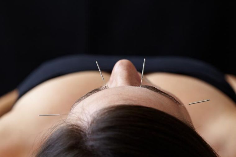 acupuncture-effets-risques-maigrir