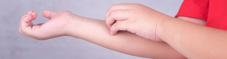 allergies chez l'enfant-inflammation de la peau