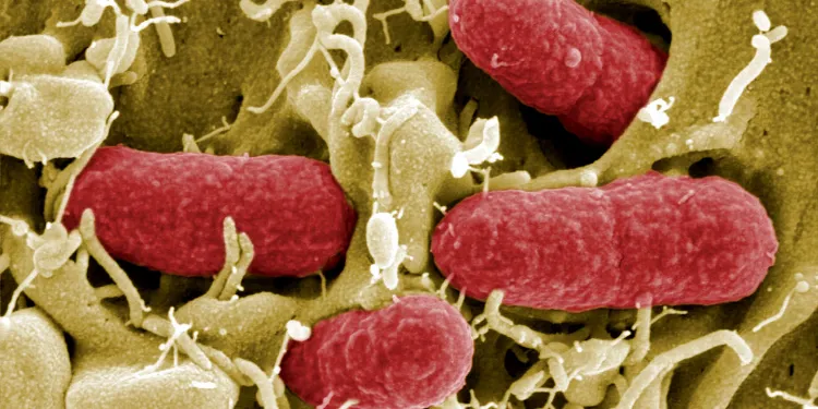 autorités santé tirent sonnette alarme e coli