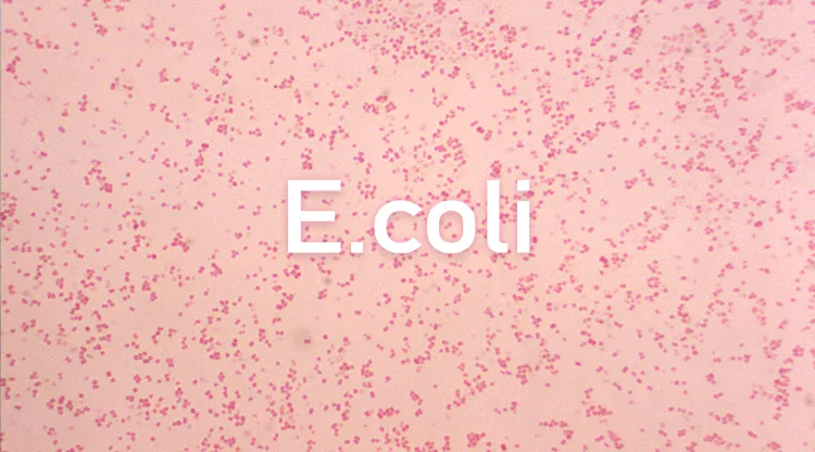 bactérie e coli symptômes