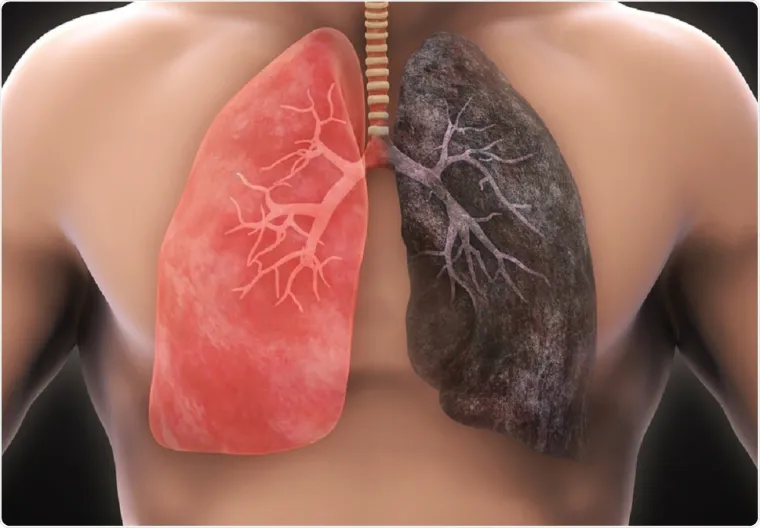 cancer du poumon mutations cellules