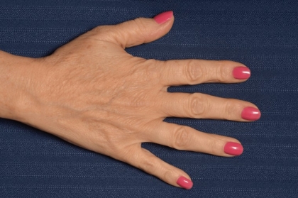 joli vernis ongle main femme âgée